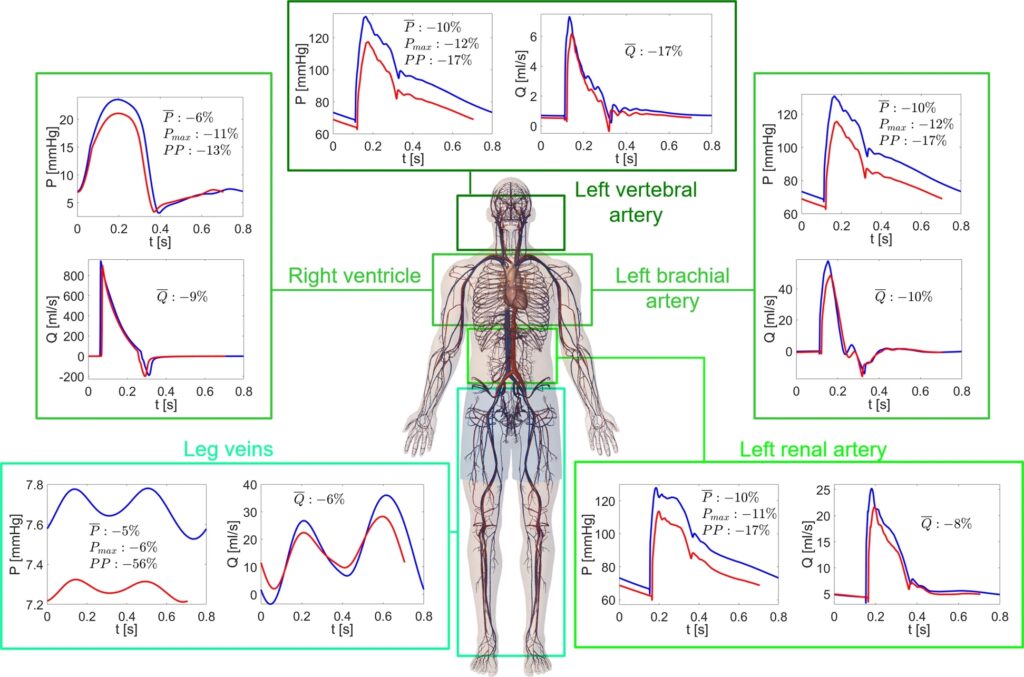 Fig. 1: Pressures and flow rates throughout the body in 1G supine and 0G conditions. From: Cardiovascular deconditioning during long-term spaceflight through multiscale modeling